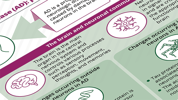 Alzheimer's Disease Infographic