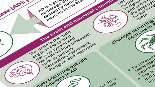 Alzheimer Disease Overview Infographic